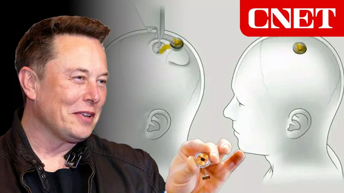 Elon Musk réussit à contrôler un ordinateur par la pensée grâce à Neuralink